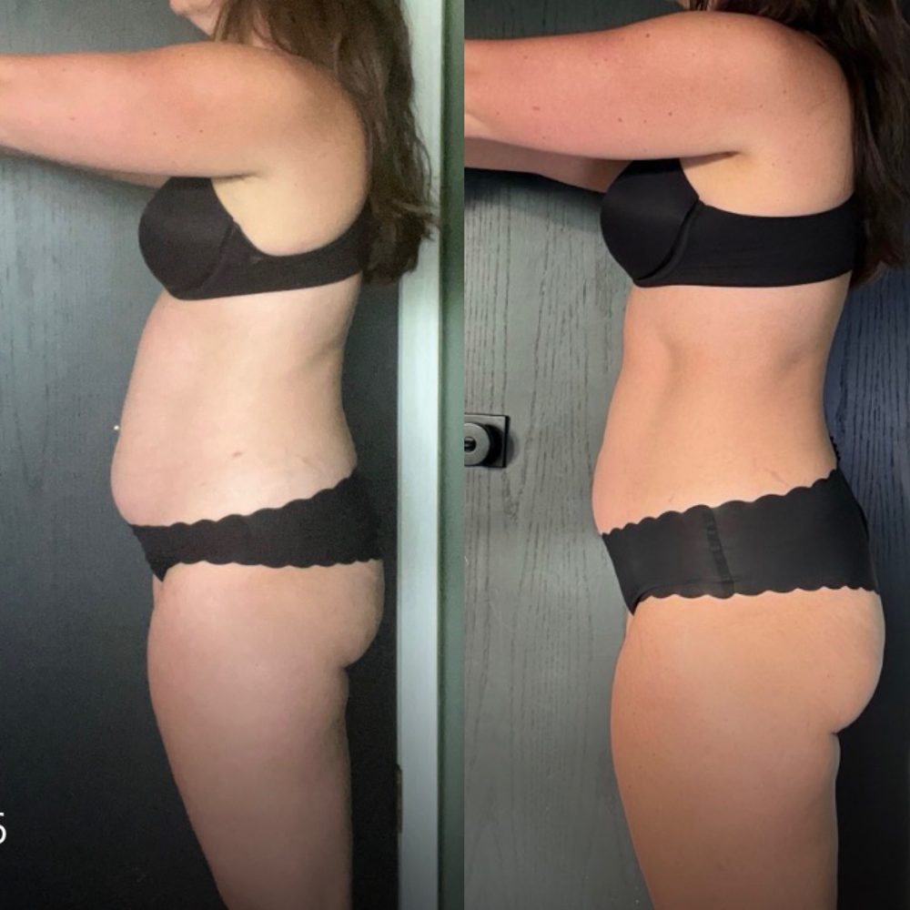 Before and after photos of a coaching client